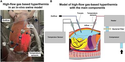 In-vivo thermodynamic exploration of gas-based intraperitoneal hyperthermia